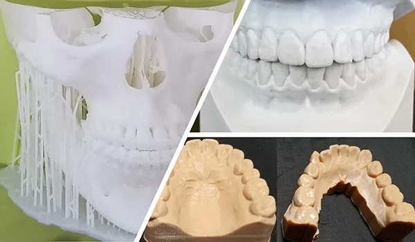 メディカル・デンタル 水洗いレジン（クラス1）